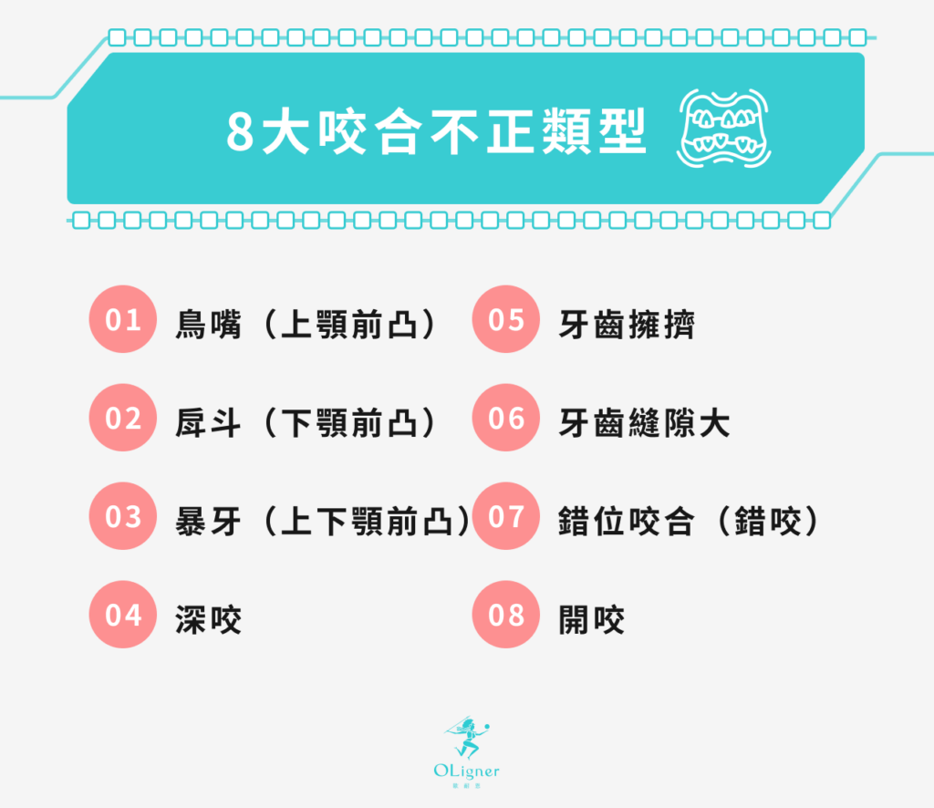 8大咬合不正類型
鳥嘴（上顎前凸）
戽斗（下顎前凸）
暴牙（上下顎前凸）
深咬
牙齒擁擠
牙齒縫隙大
錯位咬合（錯咬）
開咬