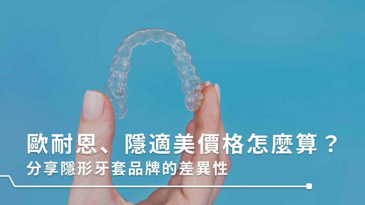 歐耐恩、隱適美價格怎麼算?分享隱形牙套品牌的差異性