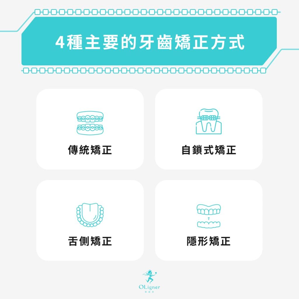 4種主要的矯正牙齒方式：傳統矯正、自鎖式矯正、舌側矯正、隱形矯正